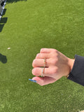 REMI RING
